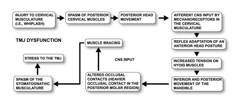 Cervical Myospasms and TMJ Treatment San Diego