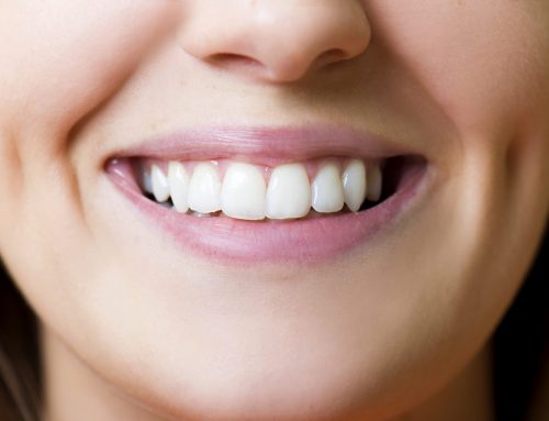 San Diego Dentist: Treatments for Bleeding Gums