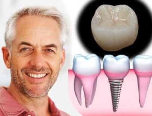 San Diego Implant Dentist