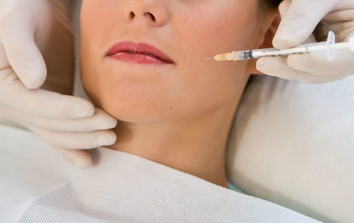 Botox Treatment for TMJ