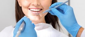 teeth cleaning san diego