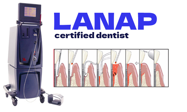 lanap dental