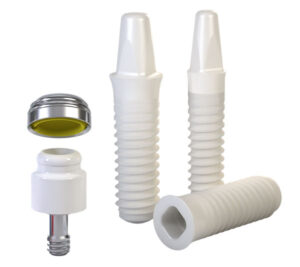 holistic biocompatible dental implants san diego